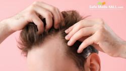 Understanding the Causes of Hair Loss and How Medications Can Help